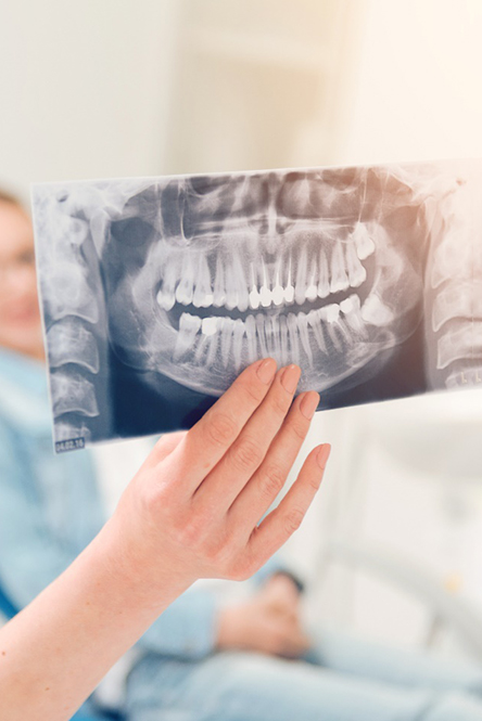 woman explaining dental x ray