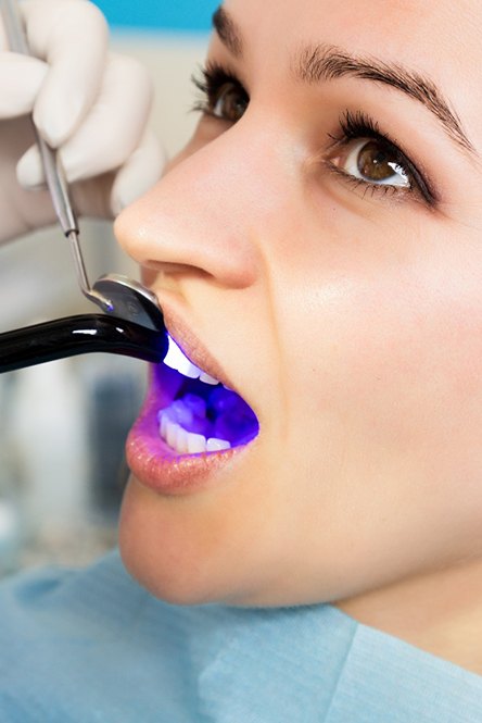 Dentist applying UV light to patient’s dental bonding