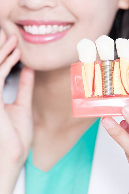 A female dentist holding an enlarged dental implant model