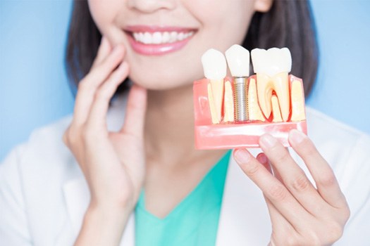 Nose-to-shoulder view of dentist touching cheek and holding model implant