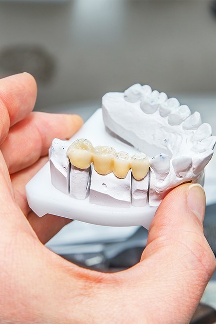 Man considering replacing missing teeth with dental bridges
