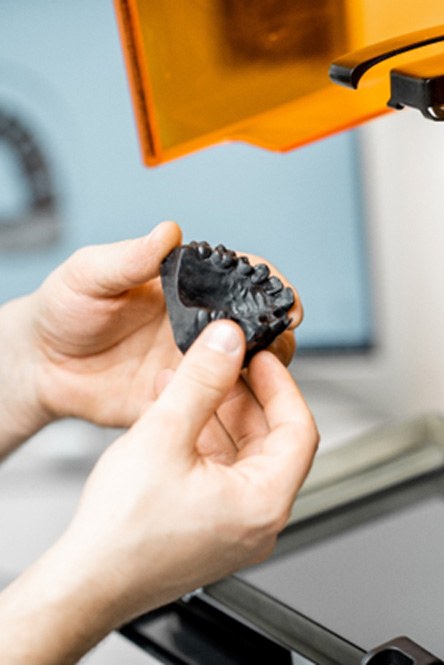 3D printed dental wax model 