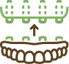Icon of a denture being affixed to four dental implants