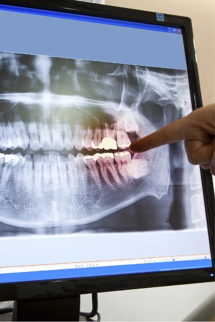 Dentist pointing to all digital x-rays