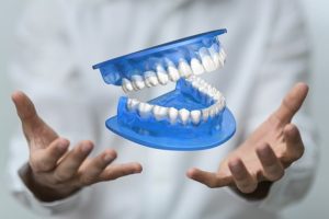 a closeup of 3D-printed tooth restorations
