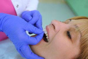 Woman with blond hair having a veneer placed on her front tooth by a dentist wearing blue gloves