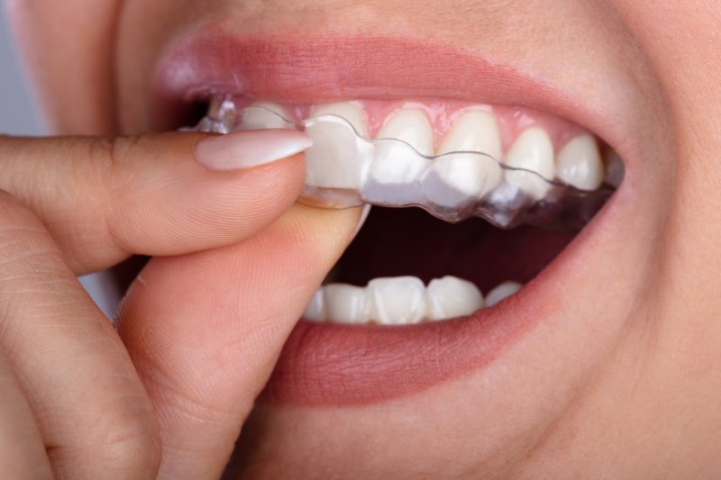 A woman removing clear aligners from her mouth